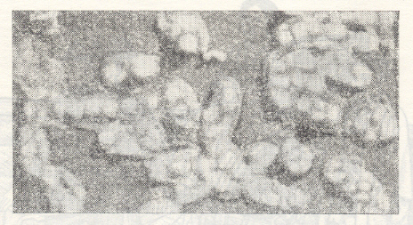 आ. १. रिकेट्‌सिया मूसेरी किंवा रि. टायफी : इलेक्ट्रॅन सूक्ष्मदर्शकातून दिसणारे सूक्ष्मजंतू.