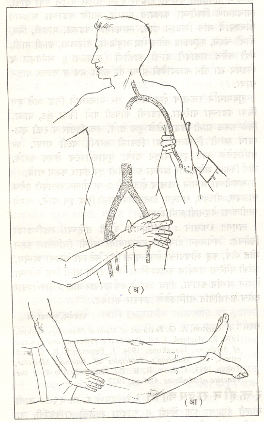 आ. ३. (अ) हात व पाय यांवरील दाब बिंदू, (आ) पायातील रक्तस्त्राव थांबविण्याकरिता उरुरोहिणीवर (मांडीतील रोहिणीवर) दाब देण्याची जागा.
