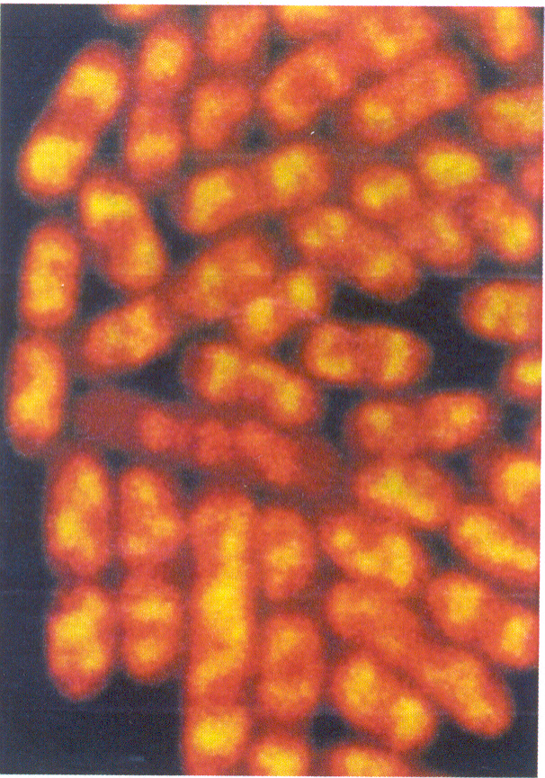 साल्वोनेला एंटेरिडिटिस सूक्ष्मजंतूंची गुणसूत्रीय संरचना (कोशिकाद्रव्य नारिंगी व गुणसूत्रे पिवळ्या रंगात)