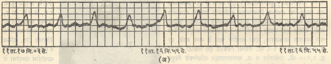 आ. १.(अ) पल्साराचा आलेख : ऊटी येथे नोंदलेल्या एका पल्साराचा (पीएसआर ००३१—०७)आलेख