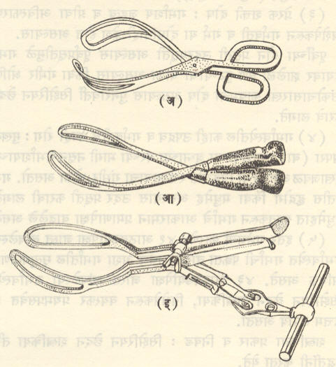 आ. १५. प्रसूती संदंशाचे प्रकार : (अ) चेंबरलिन संदंश (चिमट्याचा सुरुवातीचा प्रकार) (आ) स्मेली संदंश (इ) मिल्न मरी संदंश. 