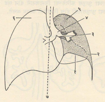 आ. ८. डाव्या फुप्फुसाच्या संपुंजित फुप्फुसपाताचे मध्यावकाशातील अवयवांवर होणारे परिणाम : (१) डावे मध्यपटल वर उचलले जाते, (२) हृदय डाव्या बाजूस सरकते, (३) प्रमुख श्वासनलिकेच्या अवकाशिकेतील अर्बुद, (४) श्वासनाल डाव्या बाजूस सरकतो, (५) डाव्या फुप्फुसाचा संपुंजित फुप्फुसपात, (६) उजव्या फुप्फुसाची प्रतिपूरक वातस्फीती, (७) मध्यरेषा.