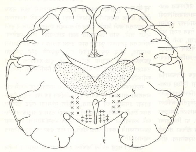 आ. ३. प्ररमस्तिष्काचा छेद दर्शवणारी आकृती( अन्नसेवन केंद्रे व तृप्ती केंद्रे अधोथॅलॅमसाच्या मध्यरेषेच्या दोन्ही बाजूंस असतात): (१) प्रमस्तिष्क बाह्यक (बाह्य स्तर), (२) स्वेत द्रव्य, (३) थॅलॅमस, (४) तिसरे मस्तिष्क विवर, (५) अन्नसेवन केंद्र, (६) तृप्ती केंद्र. 