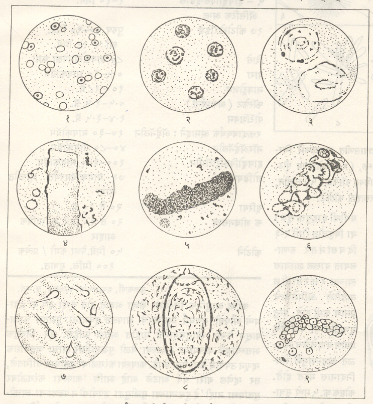 आ. १. मूत्र अवसादात सूक्ष्मदर्शकाखाली दिसणारे पदार्थ : (१) रक्तातील लाल कोशिका, (२) पू कोशिका, (३) अधिस्तर कोशिका, (४) काचाभ साचा, (५) कणमय साचा, (६) रक्तातील श्वेत कोशिकांचा साचा, (७) शुक्राणू, (८) शिस्टोसोमा, (९) रक्तातील कोशिकांचा साचा.